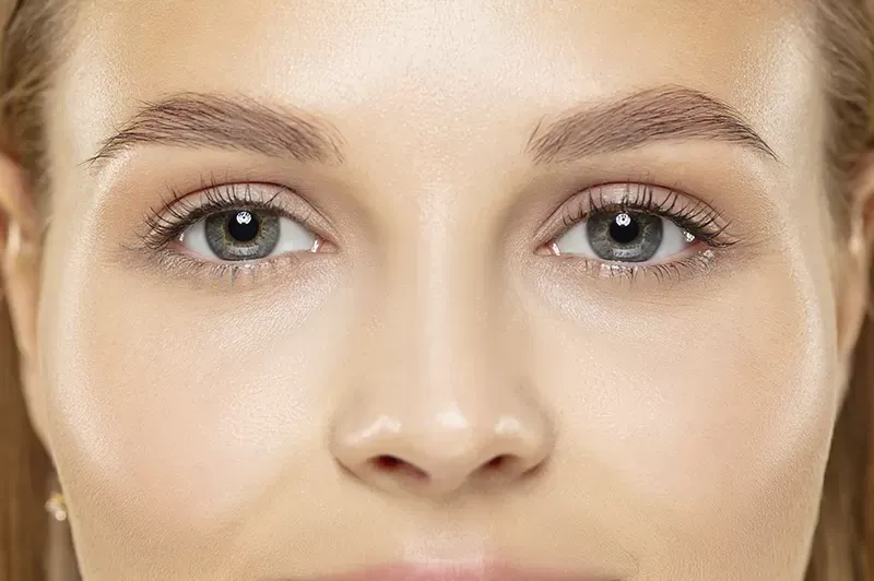 blefaroplastia mijas